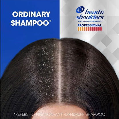Head & Shoulders Shampoo Anti Dandruff Professional Severe Dandruff Advanced Oil Control 300ml