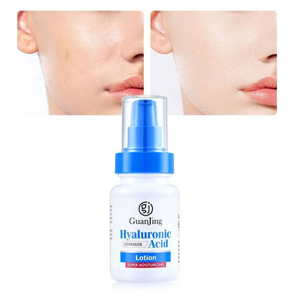Guan Jing Hyaluronic Acid & Ceramide Super Moisturizing Lotion 100g