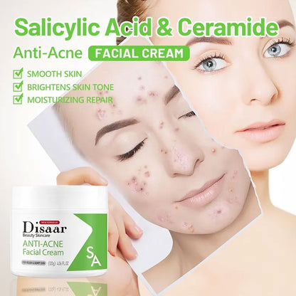 Disaar Anti Acne Facial Cream 120g