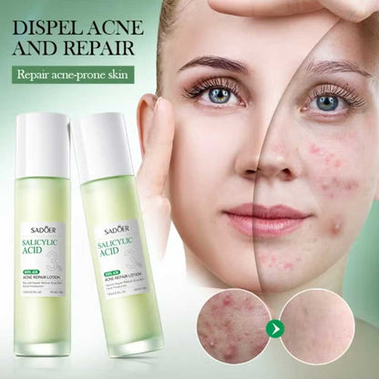 Sadoer Salicylic Acid 3% Acne Repair Lotion 100ml