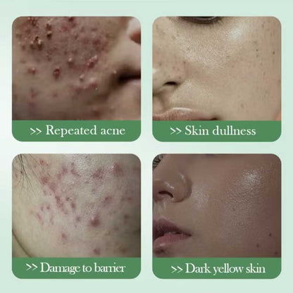 Sadoer Salicylic Acid 3% Acne Repair Lotion 100ml