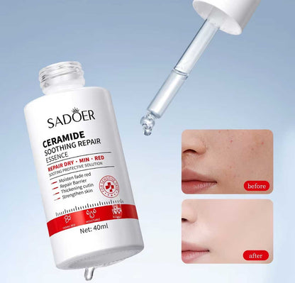 Sadoer Ceramide Soothing Repair Essence 40ml