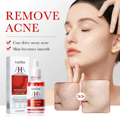 Sadoer AHA BHA Fruit Acid Acne Repair Serum 30ml