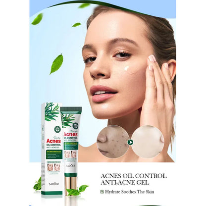 Sadoer Tea Tree Acne Oil Control Gel 20g
