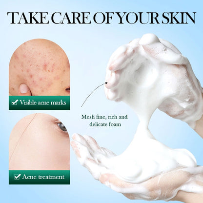 Sadoer Tea Tree Acne Oil Control Clean Mousse 150g