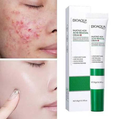 Bioaqua Salicylic Acid Acne Removal Cream 20g
