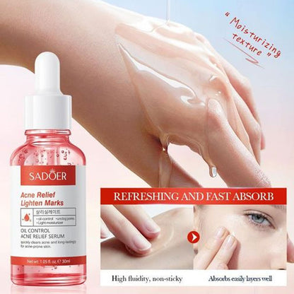 Sadoer Oil Control Acne Relief Serum 30ml