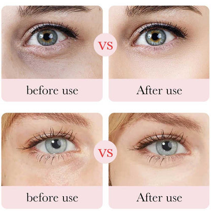 Bioaqua Rose Hyaluronic Acid Moisturizing Eye Mask 80g