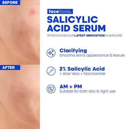 Face Facts Salicylic Acid Serum 30ml