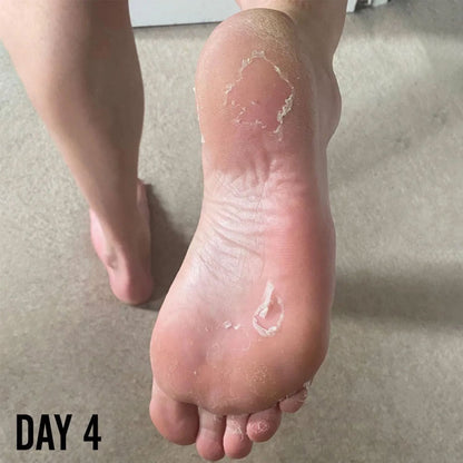 Barber Pro Foot Peel