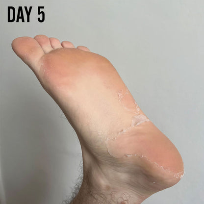 Barber Pro Foot Peel