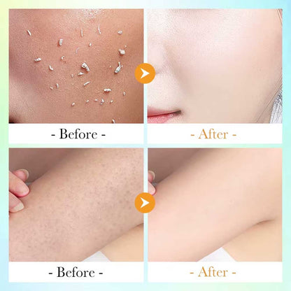 Sadoer Vitamin C Mild Exfoliating Spray 100ml